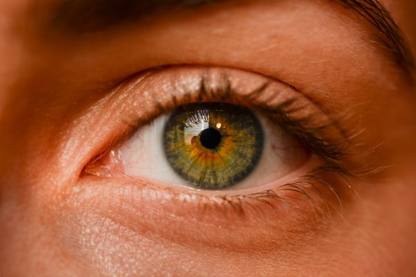 iris